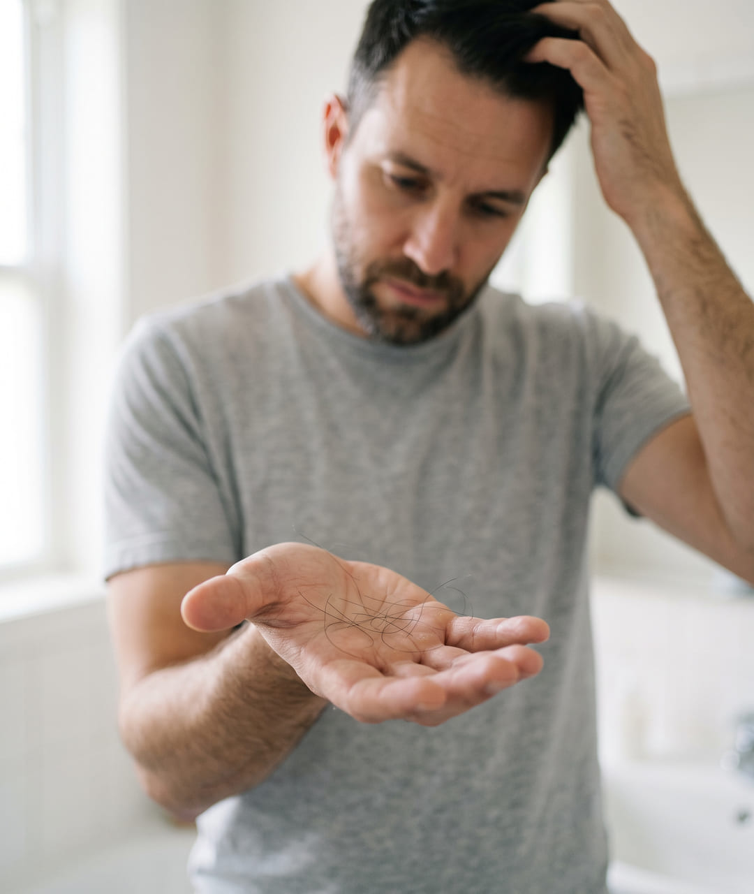 Homem olhando fios de cabelo soltos na palma da mão